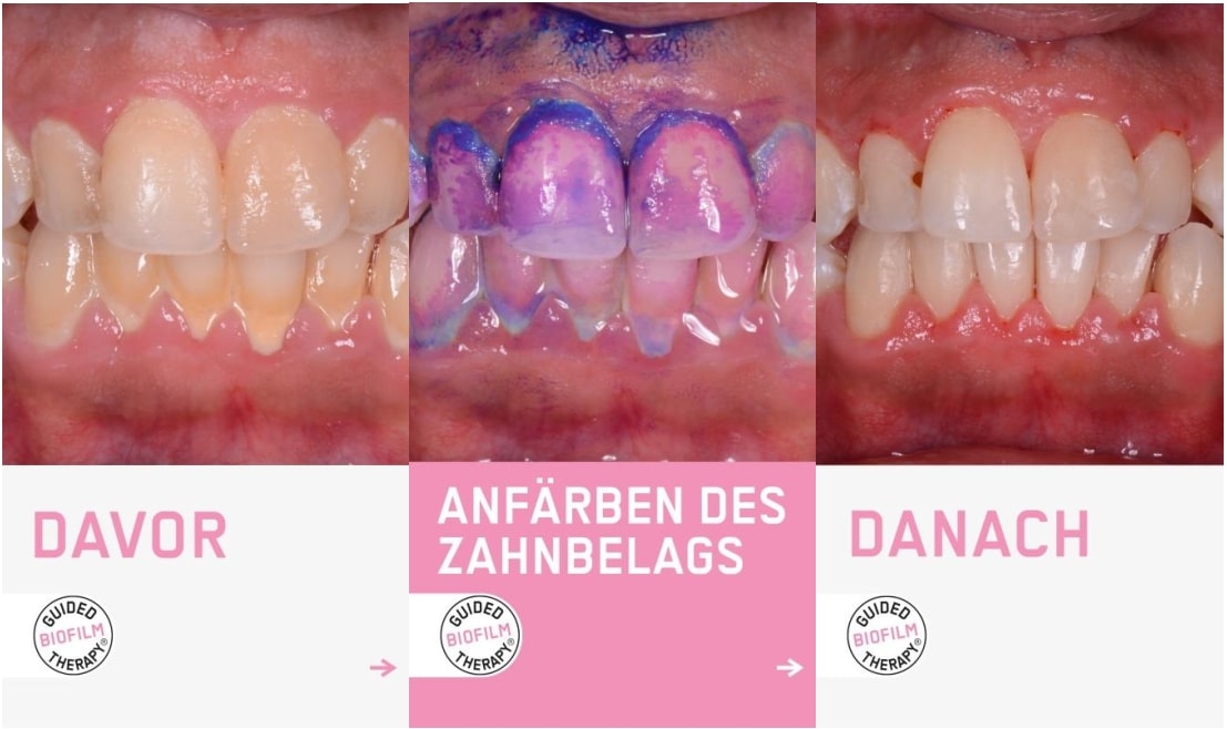 Zahnarzt Berlin Lichtenberg